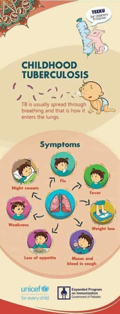 Childhood tuberculosis 